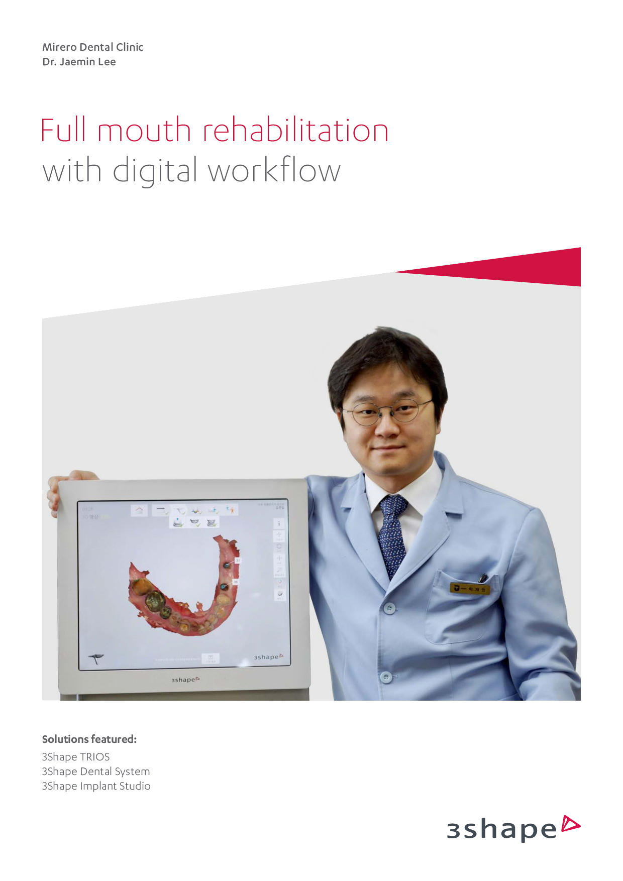 Full Mouth Rehabilitation With Digital Workflow